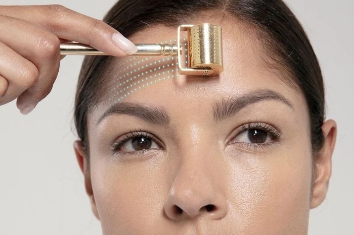 Microneedling